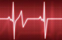 نقش اختلال ریتم قلب در بروز سکته مغزی نقش اختلال ریتم قلب در بروز سکته مغزی