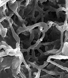 تولید قطعات زیستی برای پیوند های استخوانی در دانشگاه امیرکبیر تولید قطعات زیستی برای پیوند های استخوانی در دانشگاه امیرکبیر