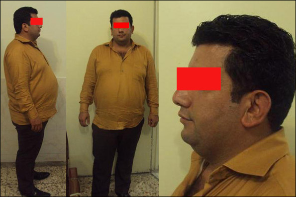 کلاهبرداری با وعده ازدواج تا تخریب کنندگان خودروهای مهمانان عروسی کلاهبرداری با وعده ازدواج تا تخریب کنندگان خودروهای مهمانان عروسی