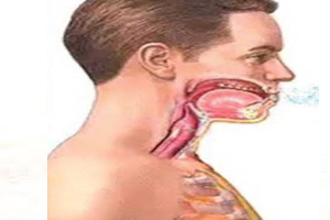 سرفه های خشک را جدی بگیریم سرفه های خشک را جدی بگیریم