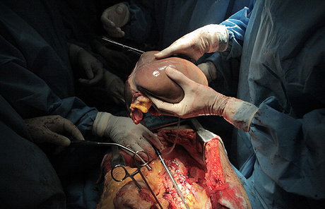 راهی برای زنده ماندن