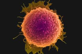 به صدا درآمدن زنگ خطر سرطان به صدا درآمدن زنگ خطر سرطان