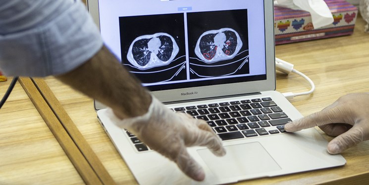 سامانه هوشمندبرای تخمین بیماری از روی چشم