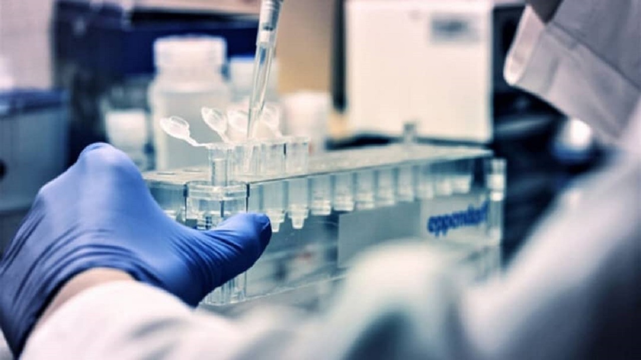 پلاسمای اهدایی بهبودیافتگان کرونا، صرفا برای درمان بیماران استفاده می‌شود