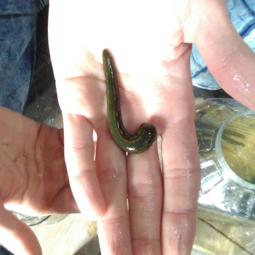 خارج کردن زالوی زنده از حلق بیمار کنگاوری خارج کردن زالوی زنده از حلق بیمار کنگاوری