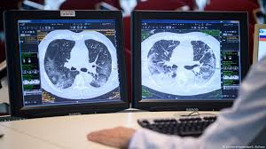 آسیب های روحی و روانی کرونا در جامعه