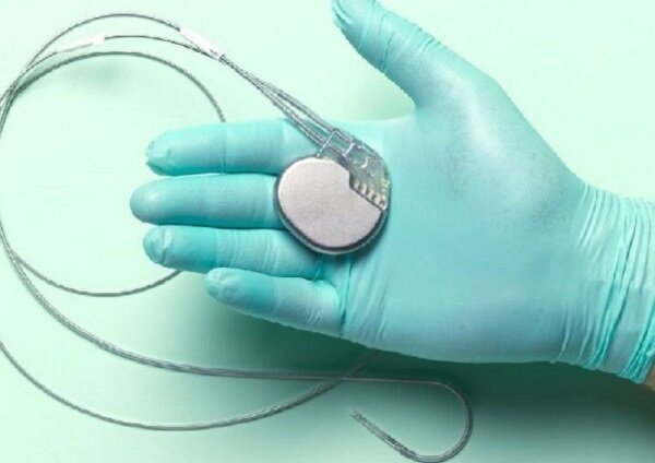 ساخت شارژ بی سیم ضربان ساز قلب برای نخستین بار در کشور ساخت شارژ بی سیم ضربان ساز قلب برای نخستین بار در کشور