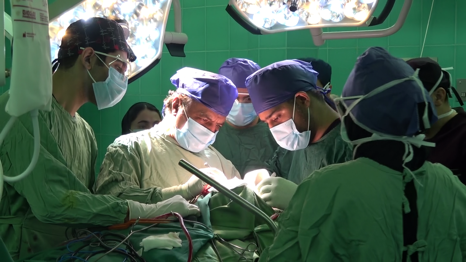انجام جراحی «کالوزوتومی» برای درمان تشنج مقاوم به دارو در بیمارستان رازی بیرجند