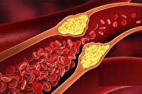 راهکار‌های افزایش اثربخشی دارو‌های کاهنده چربی خون