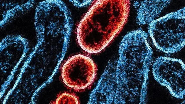 بیماری نیپا هیچ دارو یا واکسنی ندارد