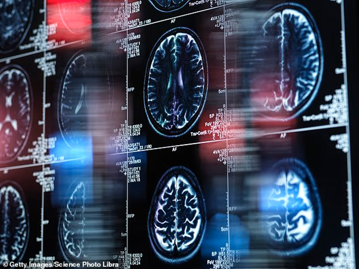 اکنون بیش از نیم میلیون نفر در بریتانیا با زوال عقل زندگی میکنند اکنون بیش از نیم میلیون نفر در بریتانیا با زوال عقل زندگی میکنند