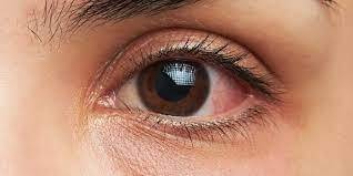 چگونه چشم هایمان را در خانه معاینه کنیم؟