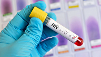 دعوت به مشارکت در پویش ملی تست رایگان HIV