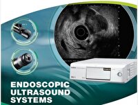 تحویل دستگاه پیشرفته‌ اندوسونوگرافی به بیمارستان امام خمینی (ره) اردبیل